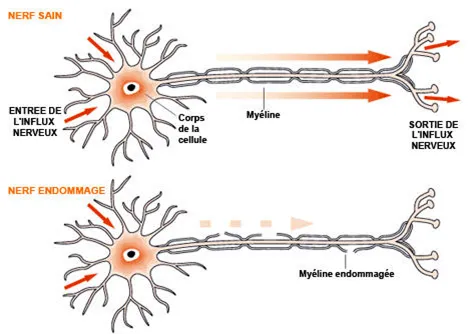 Figure 2 Les cellules nerveuses se prolongent par des « axones », recouverts d’une gaine blanche de myéline. Ce sont ces axones, constituant un véritable câblage dans le cerveau, qui composent la substance blanche dans laquelle se forment les lésions au cours de CADASIL