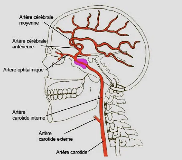 Figure 1: L’artère carotide interne est l’artère principale qui permet d’amener le sang au cerveau. C’est elle qui est généralement atteinte dans la maladie de Moya Moya. Elle se divise pour donner l’artère cérébrale antérieure et l’artère cérébrale moyenne, qui peuvent également se rétrécir.