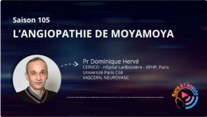 Capsule Rare &agrave; l'&eacute;coute